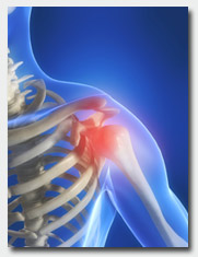 Rehab Shoulder Pain